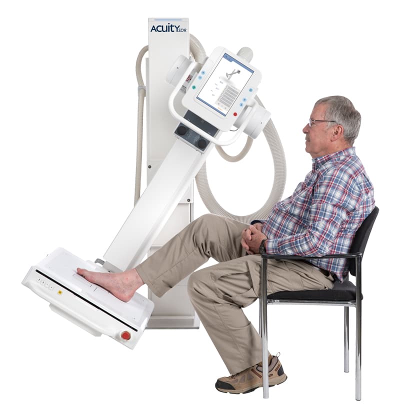 Lower Extremity X-Ray