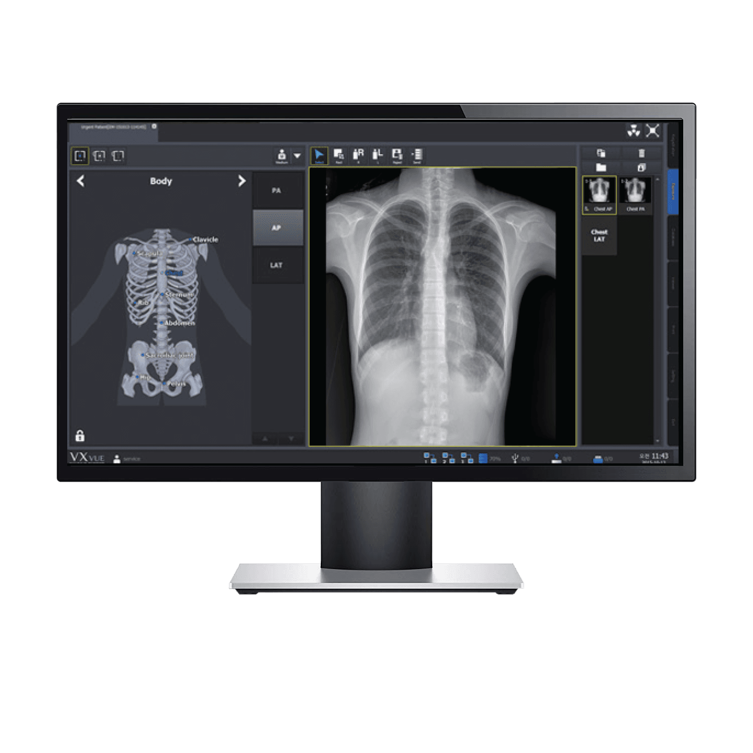 OCTAVE VXvue Image Processing Software
