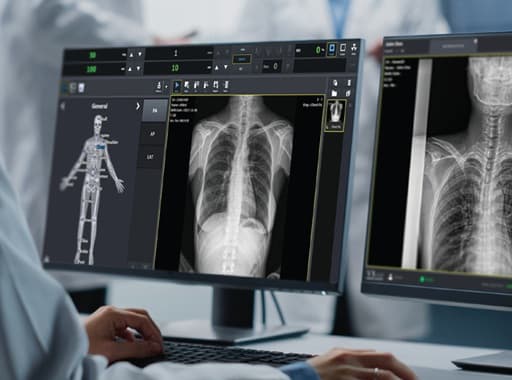 OCTAVE Generator Exposure