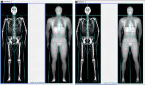 OCTAVE Image Stitching